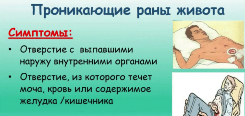 Как оказать первую помощь при травмах живота