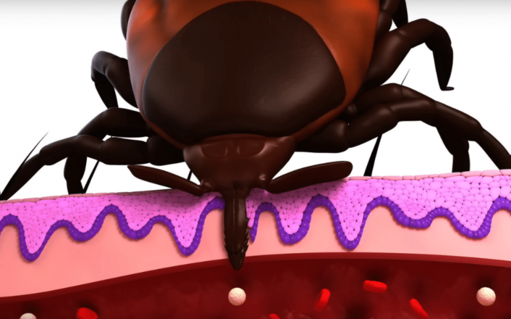 Как вытащить клеща у человека