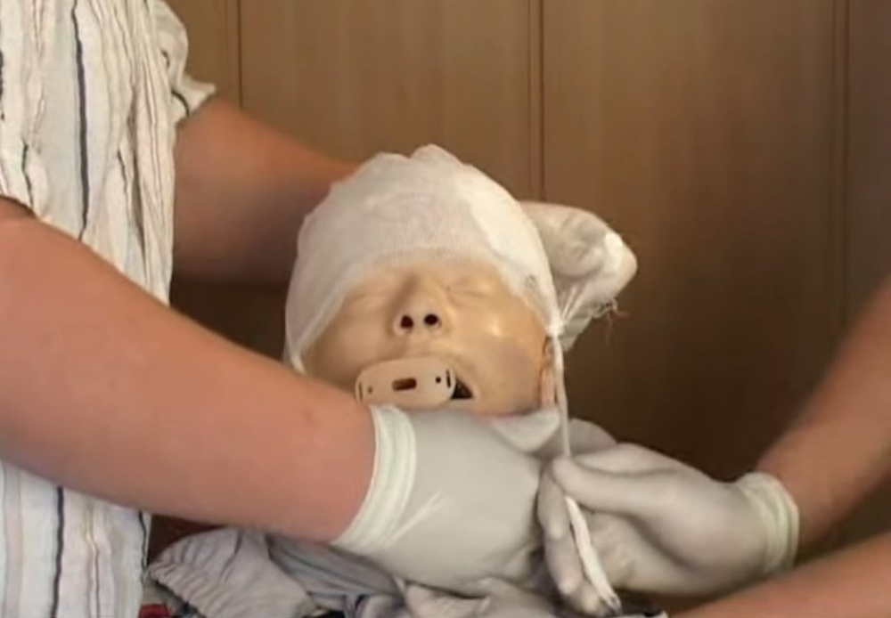 Как оказать первую помощь при травме головы
