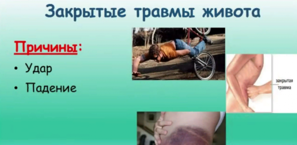 Как оказать первую помощь при травмах живота