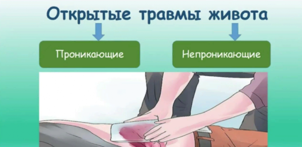 Как оказать первую помощь при травмах живота